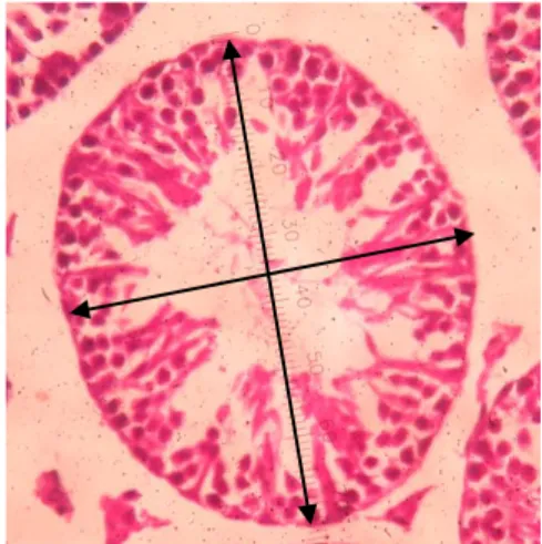 Gambar  2.  Gambaran  Pengukuran  Diameter Tubulus Seminiferus 