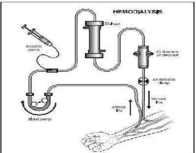 Gambar 1. Dialisat dan proses hemodialisis. 27