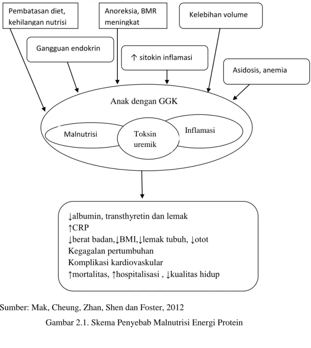 Gambar 2.1. Skema Penyebab Malnutrisi Energi Protein 