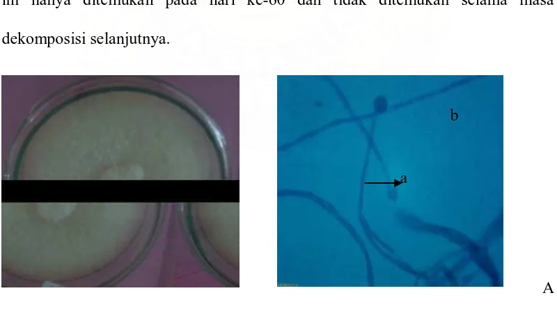 Gambar 5. Mucor sp Koloni umur 12 hari pada media PDA (A) dan Bentuk mikroskopik  (B), Sporangiofor (a), Sporangium (b)  