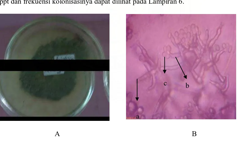 Gambar 6. Trichoderma sp. 2 Koloni umur 12 hari pada media PDA (A) dan   bentuk mikroskopik  (B), Konidiofor (a), fialid (b), konidia (c)   