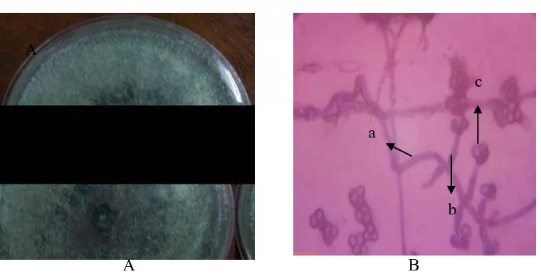 Gambar 7. Trichoderma sp.1 Koloni umur 12 hari pada media PDA (A) dan Bentuk mikroskopik  (B), Konidiofor (a), fialid (b), konidia (c)  