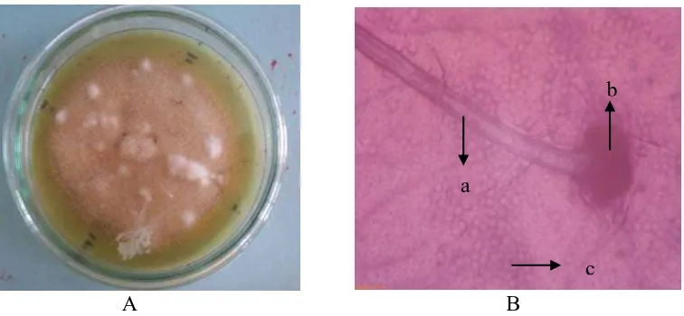 Gambar 9. Aspergillus sp. 4 Koloni umur 12 hari pada media PDA (A) dan Bentuk mikroskopik  (B), Konidiofor (a), Vesikel (b), Konidia (c)  