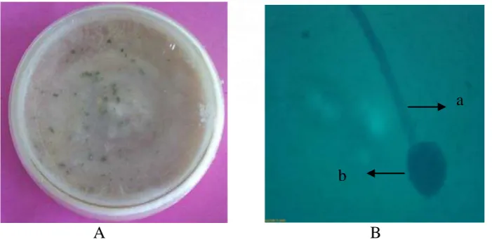 Gambar 11. Aspergillus sp. 2 Koloni umur 12 hari pada media PDA (A) dan Bentuk mikroskopik  (B), Konidiofor (a), konidia (b) 