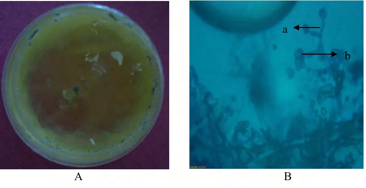 Gambar 13. Fusarium sp. Koloni umur 12 hari pada media PDA (A) dan Bentuk mikroskopik  (B), Konidiofor (a), Makrokonidia (b)  