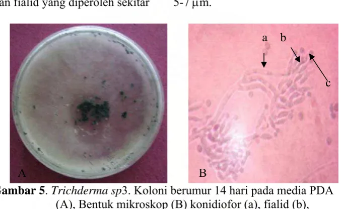 Gambar 5       . Trichderma sp3. Koloni berumur 14 hari pada media PDA (A), Bentuk mikroskop (B) konidiofor (a), fialid (b),     