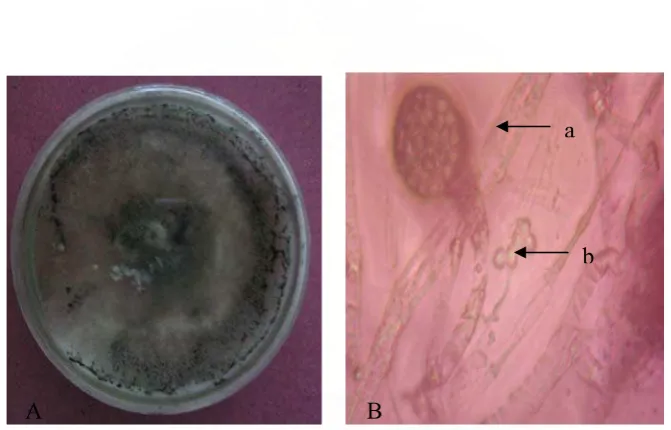 Gambar 7     Absidia sp. Koloni berumur 14 hari (A) Bentuk mikroskop (B) rhizoid (a) , sporangia(b) 