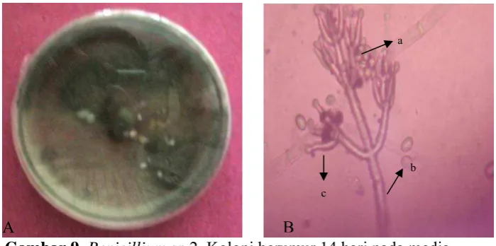 Gambar 10. Fusarium sp1. Koloni yang berumur 14 hari pada media PDA (A). Bentuk mikroskop makrokonidia (B)  