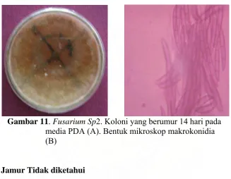 Gambar 11        . Fusarium Sp2. Koloni yang berumur 14 hari pada media PDA (A). Bentuk mikroskop makrokonidia 