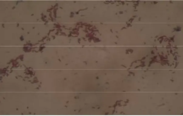Gambar 2.  Morfologi sel Agrobacterium sp di bawah mikroskop dengan perbesaran 10x100  Efek Konsentrasi EDTA terhadap produksi β-glukan 