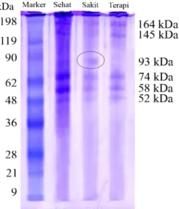 Gambar 3. Profil pita protein kulit  ketiga kelompok 