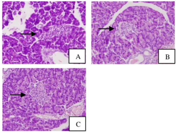 Gambar 2. Gambaran histologi pankreas tikus D1 (A),  D2 (B) dan D3 (C)