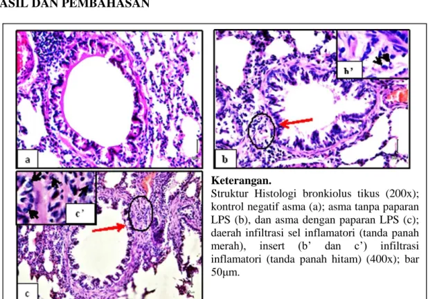Gambar 1. Gambar infiltrasi sel inflamatori pada histopatologi paru tikus  Gambar  1.a  merupakan  gambaran 