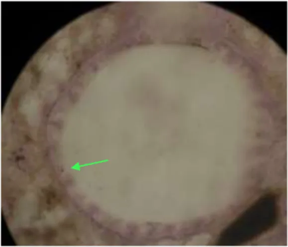 Gambar 4.1. Gambaran mikroskopis derajat inflamasi bronkus mencit                                      Balb/C grade 2