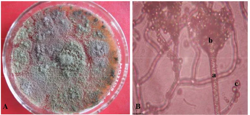 Gambar 6. Aspergillus sp. 1 koloni berumur 14 hari pada media PDA (A) dan bentuk mikroskopik (B), konidiofor (a), vesikel (b) dan konidia (c) 