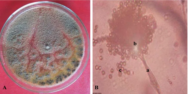 Gambar 7. Aspergillus sp. 2 koloni berumur 14 hari pada media PDA (A) dan bentuk mikroskopik (B), konidiofor (a), vesikel (b) dan konidia (c) 