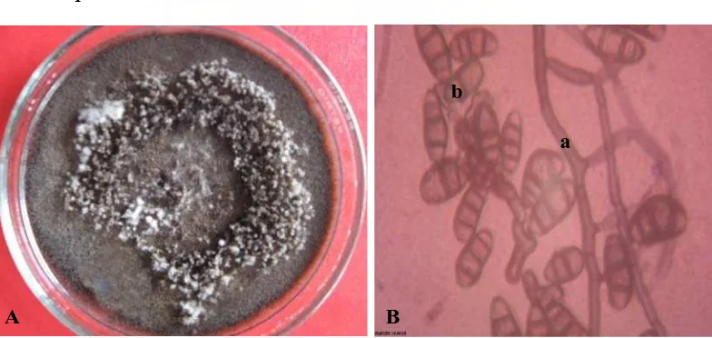  Gambar 8. Curvularia sp. Koloni berumur 14 hari pada media PDA (A) dan bentuk mikroskopik (B), konidiofor (a), konidia (porokonidia) (b)  