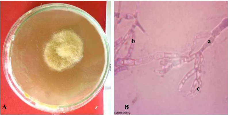  Gambar 9. Fusarium sp. koloni berumur 14 hari pada media PDA (A) dan bentuk mikroskopik (B), konidiofor (a), makrokonidia (b), mikrokonidia (c) 
