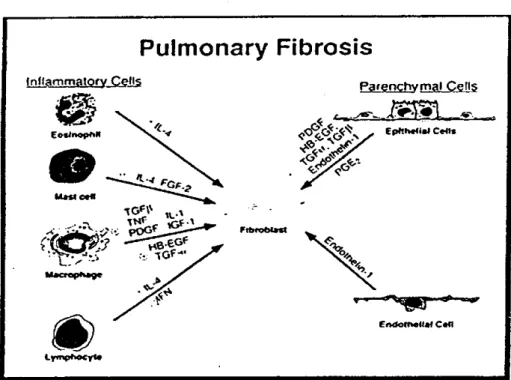 Gambar 5.3. Pada penelitian ini tampak adanya pengaruii fibrosis datang dari sel limfosit dan  makrofag yang terakffvasi, serta melalui pelepasan faktor-faktor pertumbuhan oleh sel epitel  parenkim