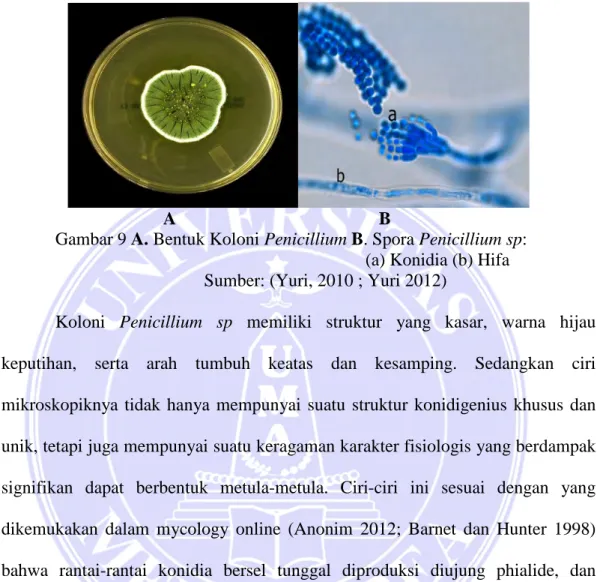 Gambar 9 A. Bentuk Koloni Penicillium B. Spora Penicillium sp: 