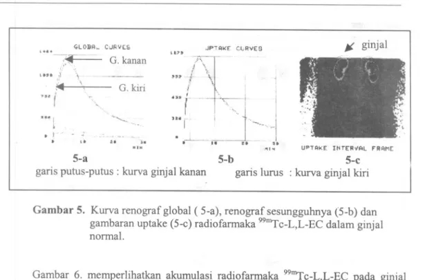Gambar 5. Kurva renograf global ( 5-a), renograf sesungguhnya (5-b) dan gambaran uptake (5-c) radiofarmaka 99mTc_L,L_ECdalam ginjal normal.