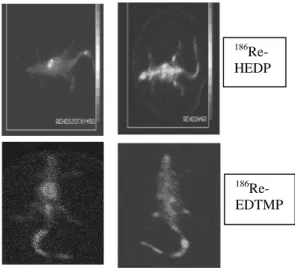 Gambar 4.  Hasil penyidikan   186 Re-HEDP  dan  186 Re-EDTMP dengan kamera gamma  pada 2 dan 24 jam setelah penyuntikan