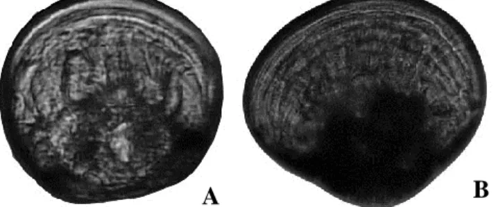 Gambar 2.  Larva  Kerang Mutiara (P. maxima) Stadia D-Veliger dan Umbo (Keterangan:  A