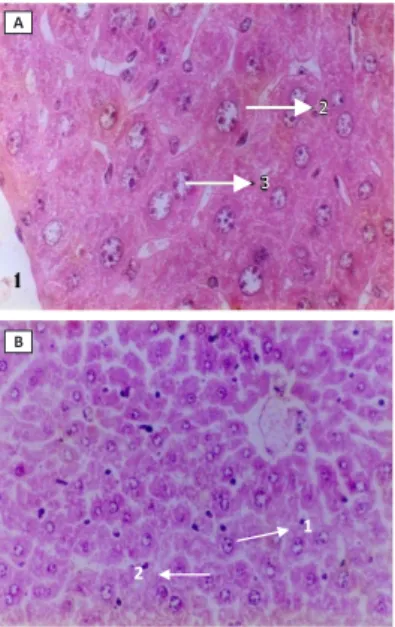 Tabel 1. Ringkasan ANOVA pengaruh paparan patulin  terhadap kerusakan struktur hepatosit mencit