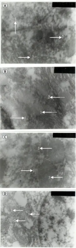 Gambar 3. Foto mikroskopis hepatosit normal dan hepatosit  yang mengalami kerusakan akibat paparan patulin pada dosis 