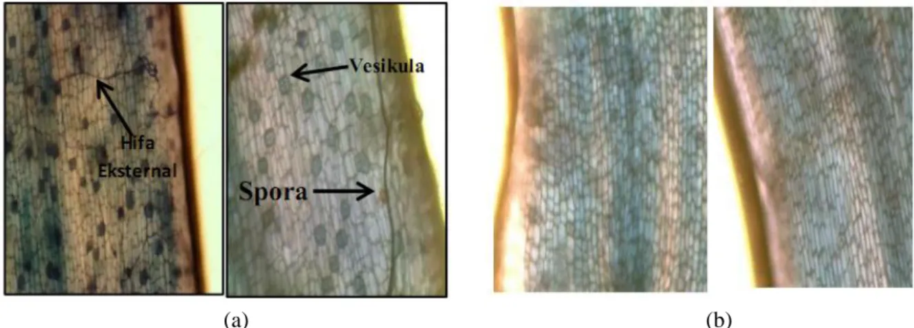 Gambar 1.  (a)  Ornamen-ornamen  indikator  persentase  kolonisasi  akar  yang  ditemukan  dalam  jaringan  korteks  akar  bibit  jelutung  rawa  yaitu  hifa,  vesikula,  spora  dengan  pembesaran mikroskop binokuler 40x