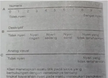 Gambar  2.  Contoh  skala  nyeri  A,  Numerik  B,  Deskriptif  verbal,  C,  Analog  visual