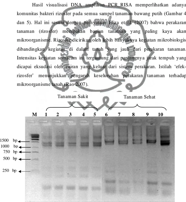 Gambar 4.  Pola fragmen DNA bakteri rizhosfer pada tanah supresif melalui PCR- PCR-RISA dengan elektroforesis horizontal menggunakan gel agarose 1500  bp 