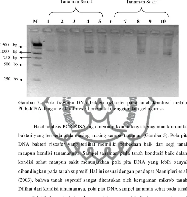 Gambar  5.    Pola  fragmen  DNA  bakteri  rizhosfer  pada  tanah  kondusif  melalui  PCR-RISA dengan elektroforesis horizontal menggunakan gel agarose 