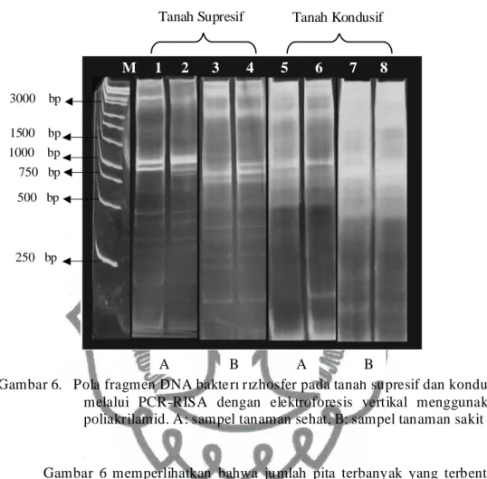Gambar 6.   Pola fragmen DNA bakteri rizhosfer pada tanah supresif dan kondusif  melalui  PCR-RISA  dengan  elektroforesis  vertikal  menggunakan  poliakrilamid
