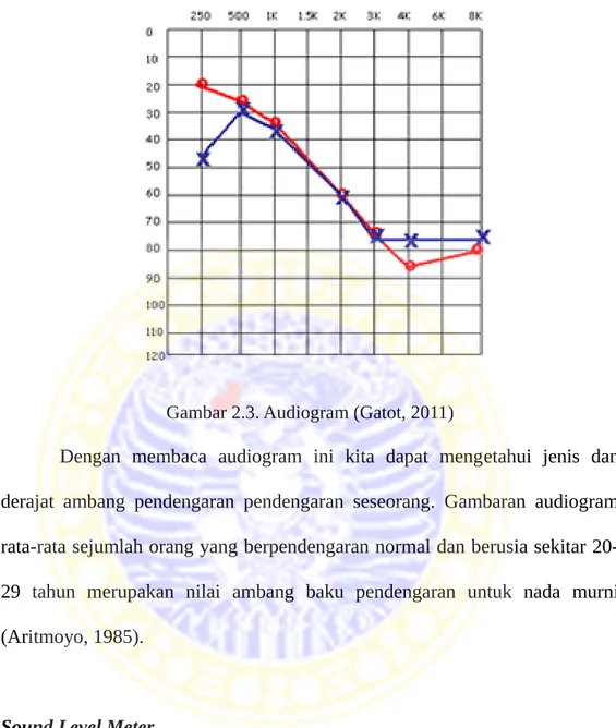 Gambar 2.3. Audiogram (Gatot, 2011)