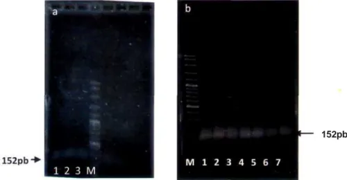 Gambar 1. Hasil eletroporesis gen Leptin babi: (a) tanpa optimasi PCR (M= Marker 1 OOpb; 1,2,3= daging babi) dan (b) hasil optimasi PCR (M= Marker 1 OOpb; no 1 s/d no 7 berturut-turut adalah suhu annealing pada 50,6;