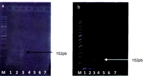 Gambar 2. Visualisasi gen Leptin babi (a) pada 2% gel agarose dan (b) pada 10-20% gel akrilamid gradient (M= Marker lOOpb; 1= sampel bakso sapi; 2 dan 3=positif kontrol daging babi; 4, 5, 6 dan 7 = sampel bakso sapi, 5= sampel bakso ayam, 6= sampel bakso s