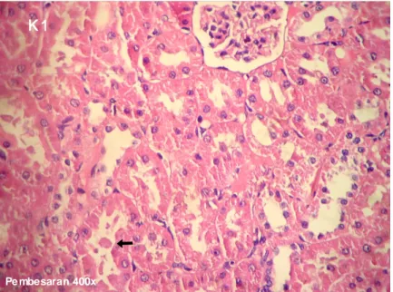 Gambar 3. Gambaran Histopatologi Tubulus Kelompok K 1