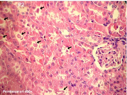 Gambar 5. Gambaran Histopatologi Tubulus Kelompok P 2