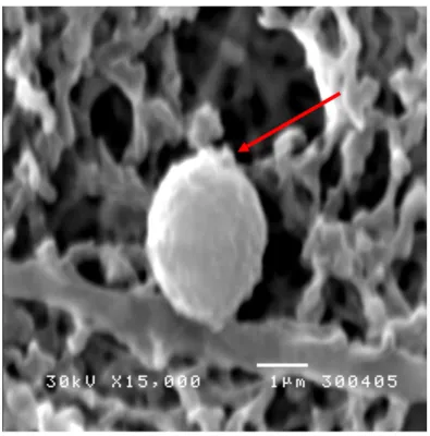 Gambar  4b    Pengaruh  ekstrak  kecombrang  dengan  konsentrasi  1  MIC  terhadap  morfologi  sel  S