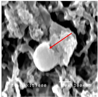 Gambar  4c    Pengaruh  ekstrak  kecombrang  dengan  konsentrasi  2  MIC  terhadap  morfologi  sel  S