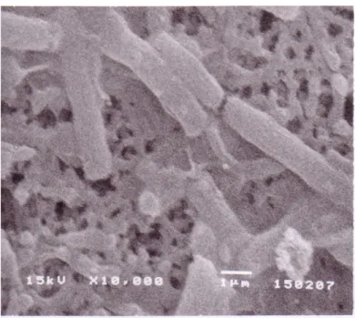 Gambar 5a  Bentuk sel normal P. aeruginosa (10.000 x)   