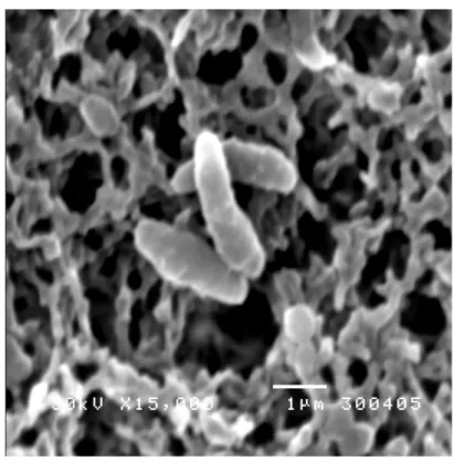 Gambar 3a   Bentuk  sel normal B. cereus (15.000 x)   