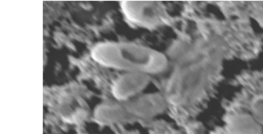 Gambar 18   Sel Vibrio harveyi yang dikontakkan dengan ekstrak Chaetoceros   gracilis (perbesaran 20 000 x)    