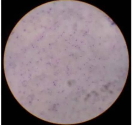 Gambar 16. Bentuk morfologi bakteri S. aureus dengan pewarnaan Gram perbesaran 1.000x 