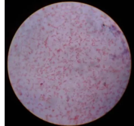 Gambar 18. Bentuk morfologi bakteri S.Typhimurium dengan pewarnaan Gram perbesaran 1.000x 