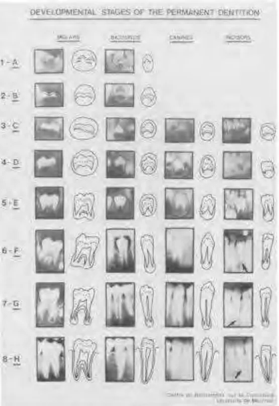 Gambar 2.1: Tahap pembentukan gigi permanen menurut Demirjian (Demirjian,  1973) 