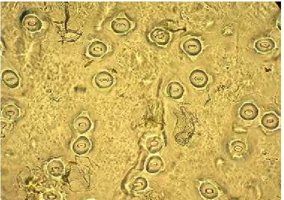 Gambar 8. Stomata Daun Nanas (Ananas comosus L. Merr.) Cv. Queen Hasil Perbanyakan In vitro Subkultur III pada Bidang Pandang Mikroskop (Perbesaran 10 x 40) 
