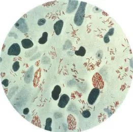 Gambar 2.1 Mycobacterium leprae dari lesi kulit (yang berwarna  merah) 
