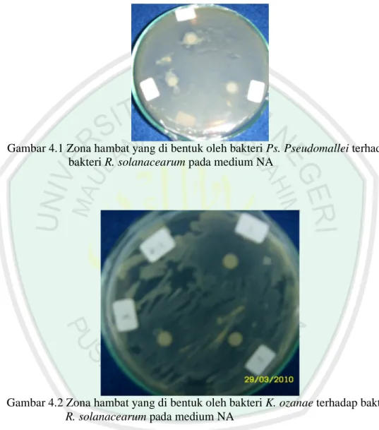 Gambar 4.1 Zona hambat yang di bentuk oleh bakteri Ps. Pseudomallei terhadap             bakteri R